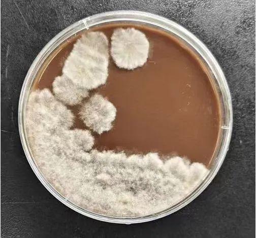 尖端賽多孢子菌所致眼部感染一例及其生物菌種分析